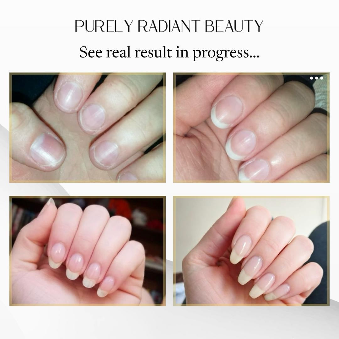 Organic Nail Growth Oil